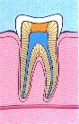 endodontic-treatment-5